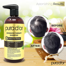 Load image into Gallery viewer, 16oz Advanced Therapy Shampoo
